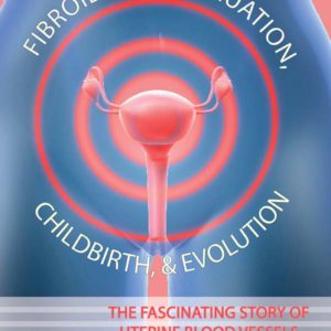 Fibroids